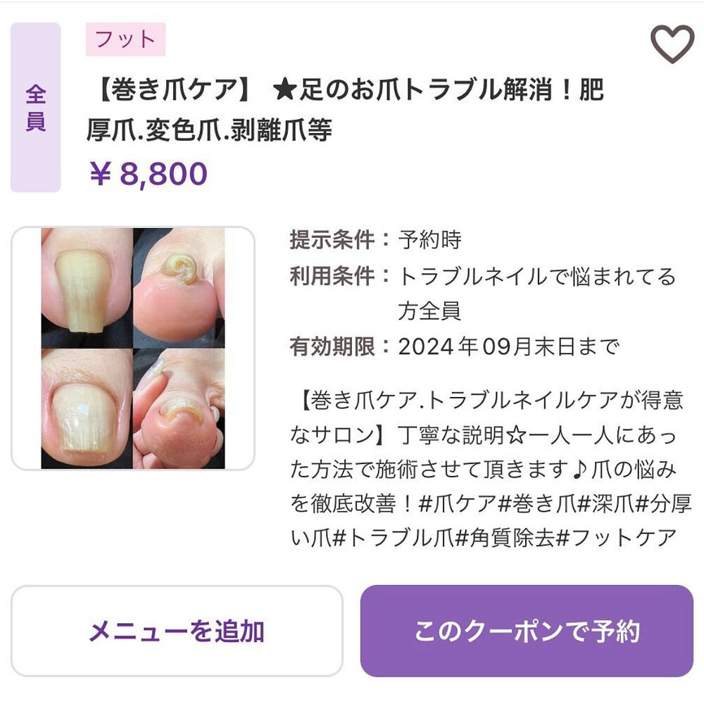 ブログ